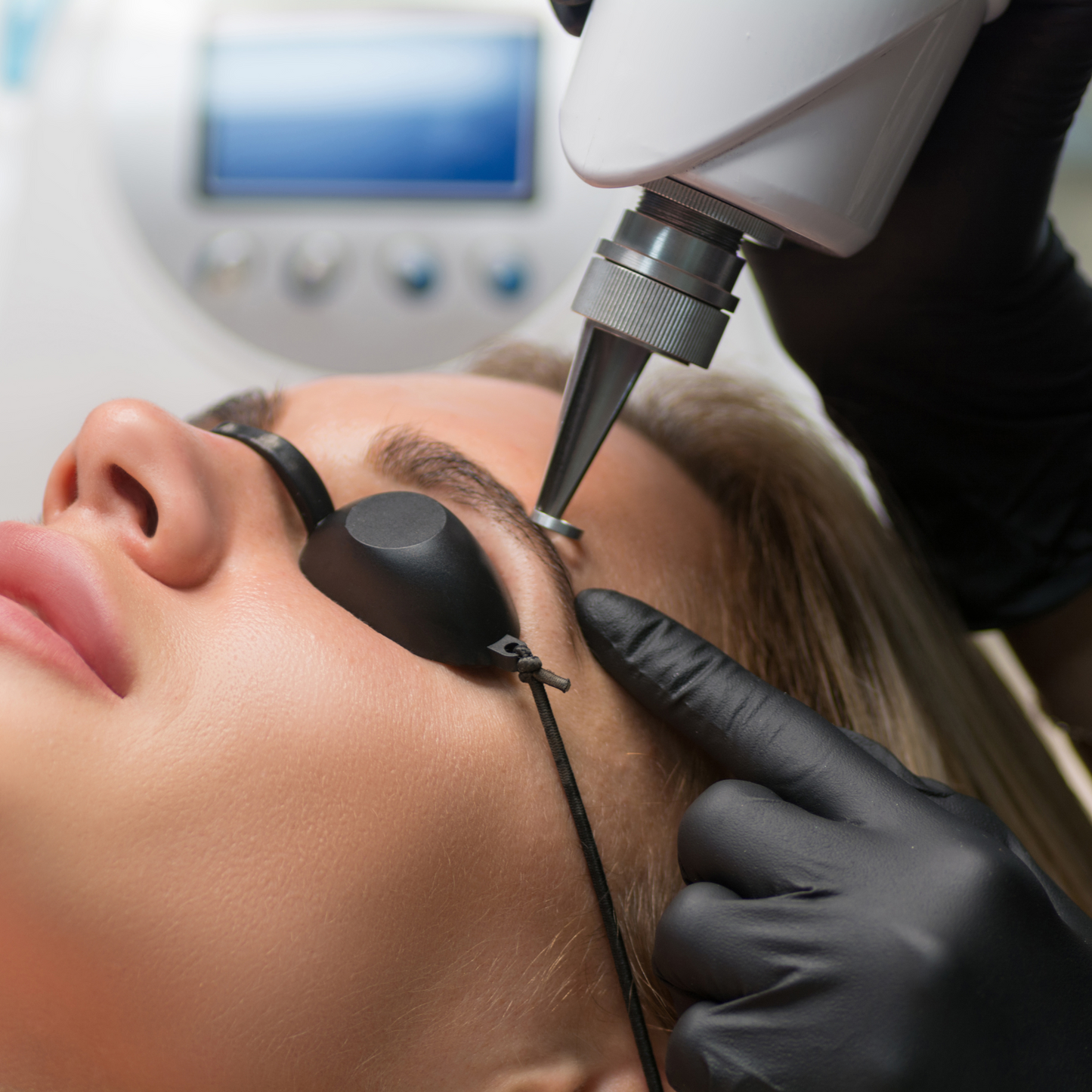 Tattoo Laser Removal